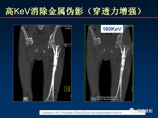 【PPT】CT能量成像的理解与应用