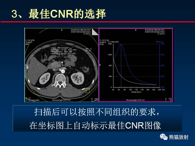 【PPT】CT能量成像的理解与应用