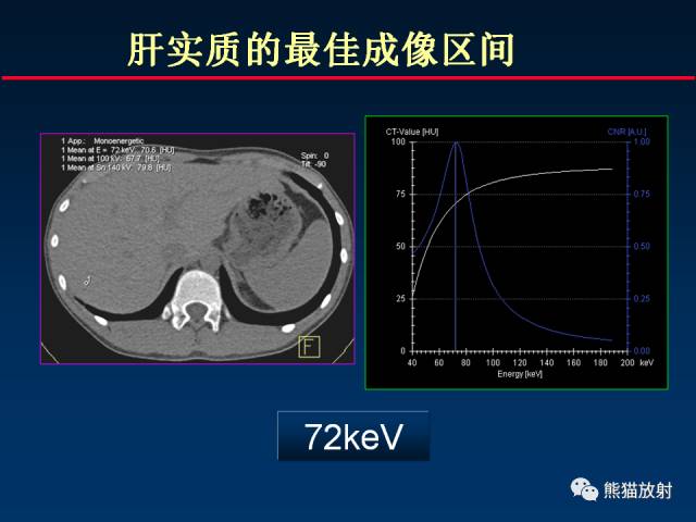 【PPT】CT能量成像的理解与应用