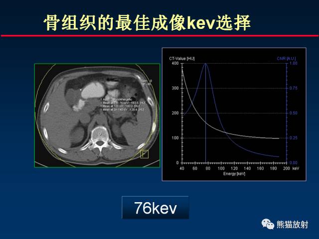 【PPT】CT能量成像的理解与应用