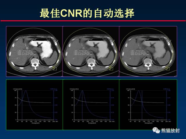 【PPT】CT能量成像的理解与应用