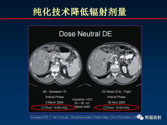 【PPT】CT能量成像的理解与应用