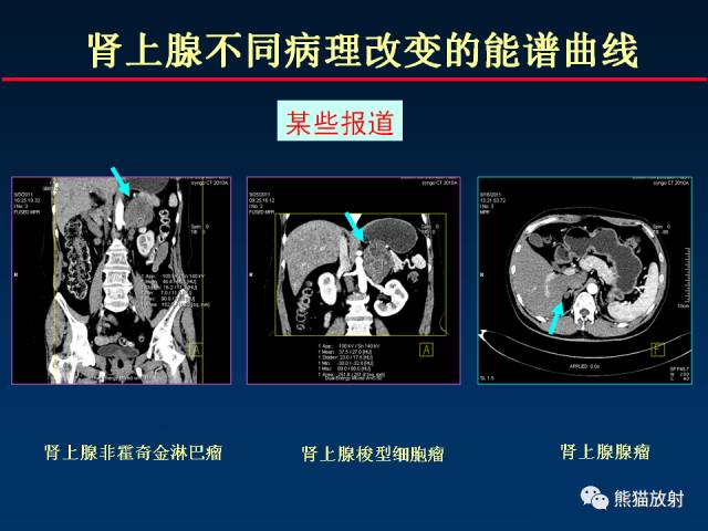 【PPT】CT能量成像的理解与应用