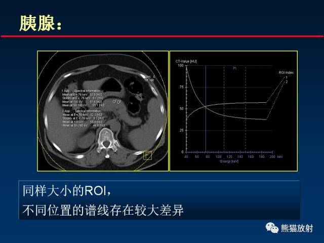 【PPT】CT能量成像的理解与应用