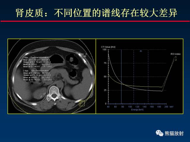【PPT】CT能量成像的理解与应用
