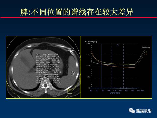 【PPT】CT能量成像的理解与应用