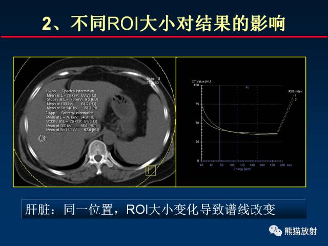 【PPT】CT能量成像的理解与应用