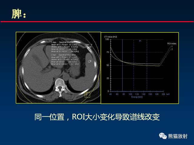 【PPT】CT能量成像的理解与应用