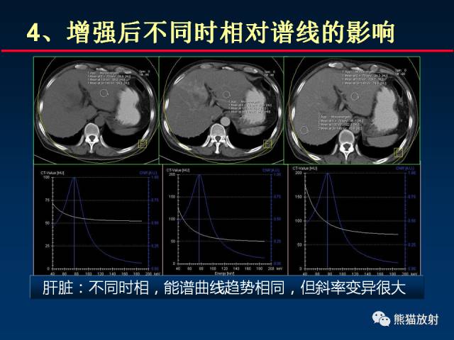 【PPT】CT能量成像的理解与应用