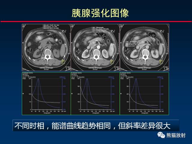 【PPT】CT能量成像的理解与应用