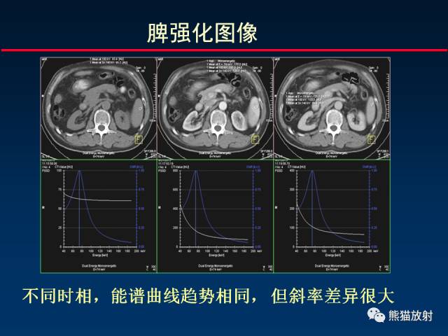 【PPT】CT能量成像的理解与应用