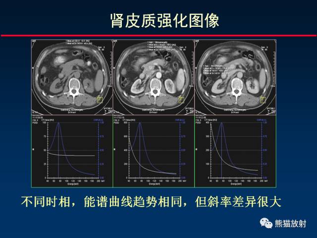 【PPT】CT能量成像的理解与应用