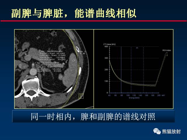 【PPT】CT能量成像的理解与应用