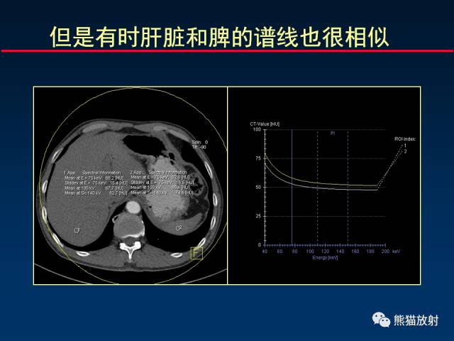 【PPT】CT能量成像的理解与应用