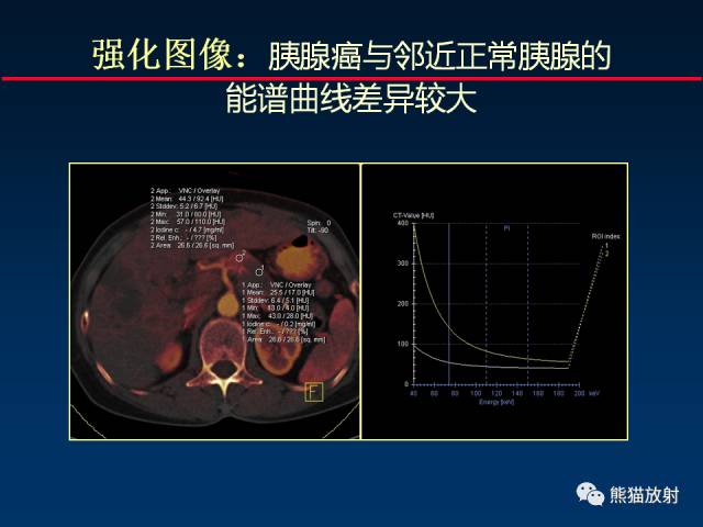 【PPT】CT能量成像的理解与应用
