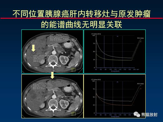 【PPT】CT能量成像的理解与应用