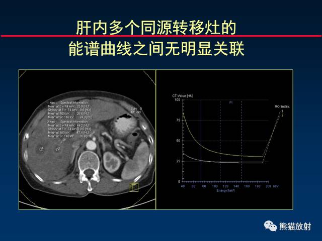 【PPT】CT能量成像的理解与应用