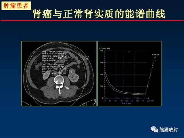 【PPT】CT能量成像的理解与应用