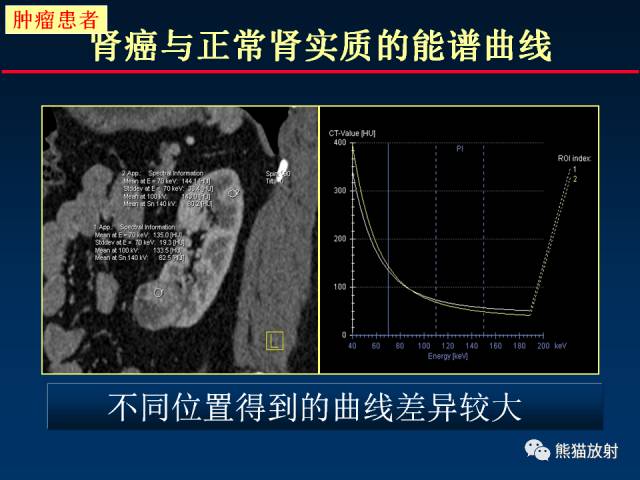 【PPT】CT能量成像的理解与应用