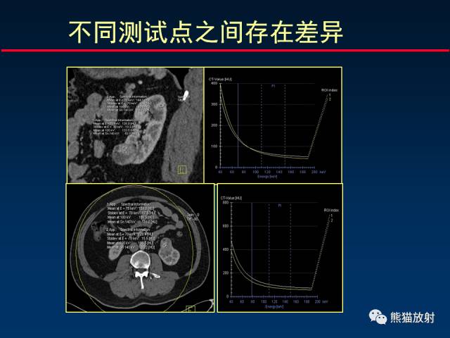 【PPT】CT能量成像的理解与应用