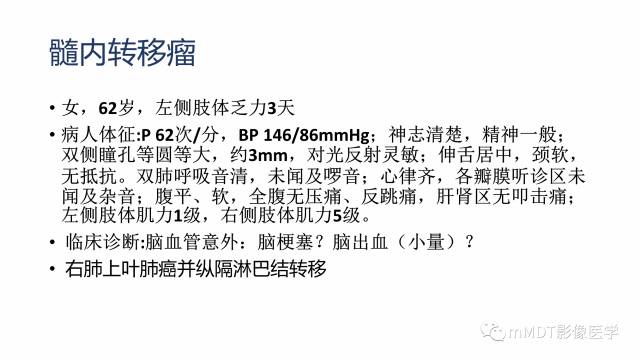【PPT】脊髓内肿瘤性病变MRI表现