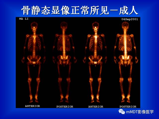 【PPT】骨骼系统核医学