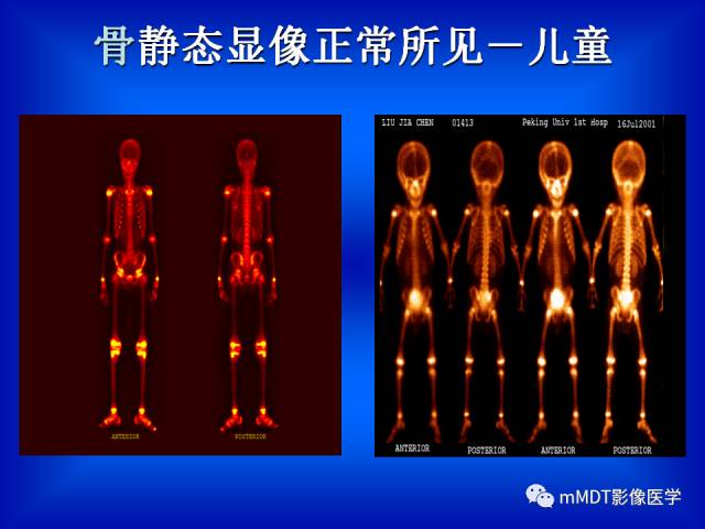 【PPT】骨骼系统核医学
