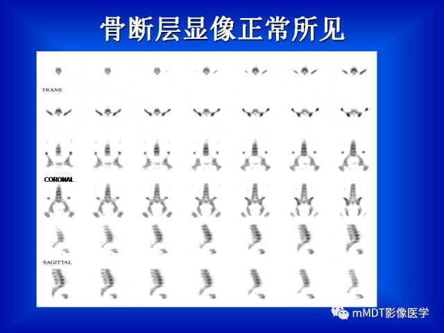 【PPT】骨骼系统核医学