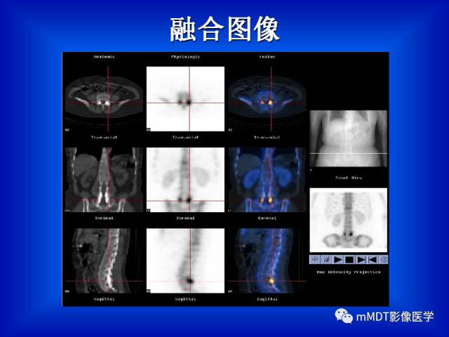 【PPT】骨骼系统核医学