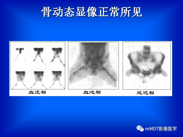 【PPT】骨骼系统核医学