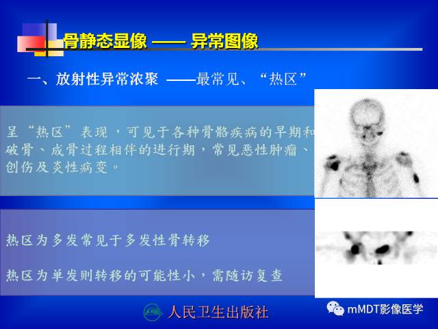 【PPT】骨骼系统核医学