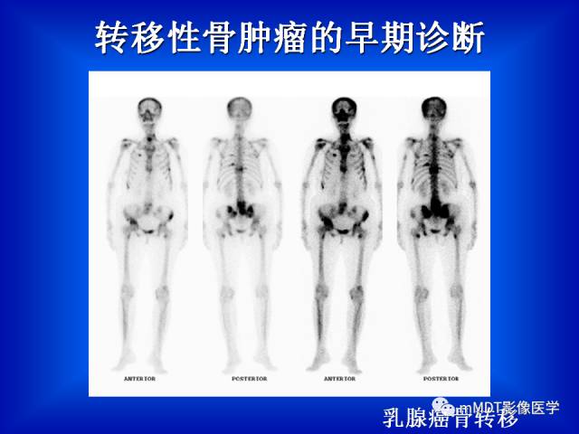 【PPT】骨骼系统核医学