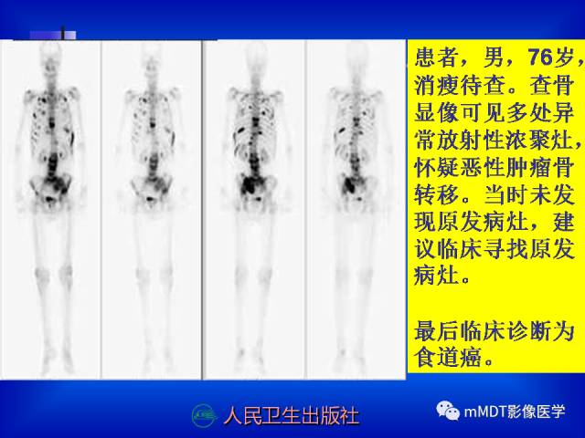 【PPT】骨骼系统核医学