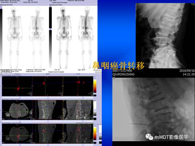 【PPT】骨骼系统核医学