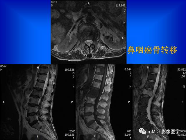 【PPT】骨骼系统核医学