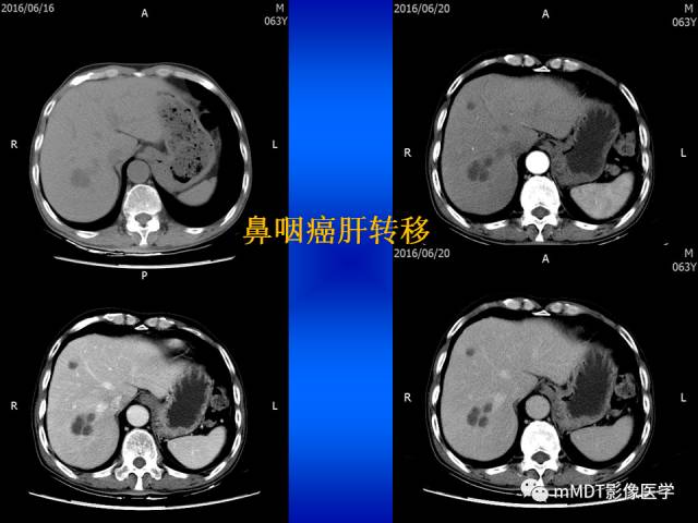 【PPT】骨骼系统核医学