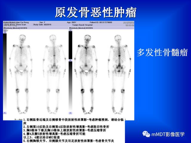 【PPT】骨骼系统核医学