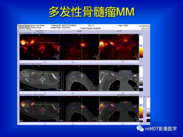 【PPT】骨骼系统核医学