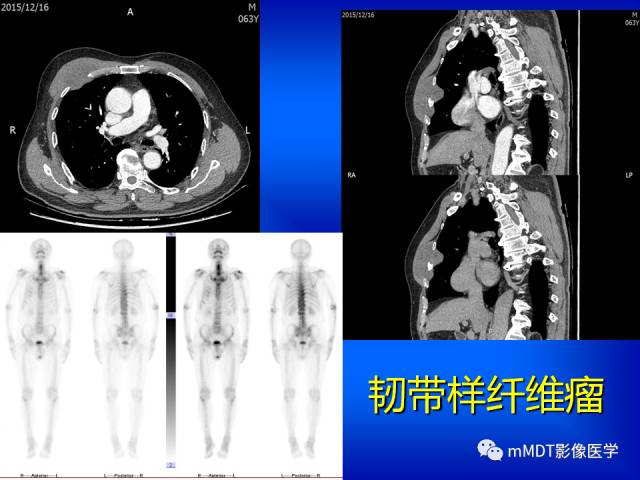 【PPT】骨骼系统核医学