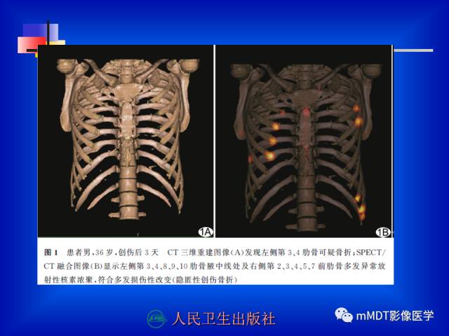 【PPT】骨骼系统核医学
