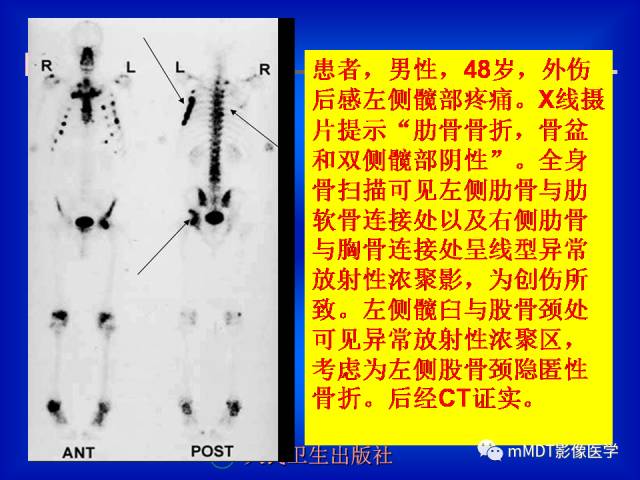 【PPT】骨骼系统核医学
