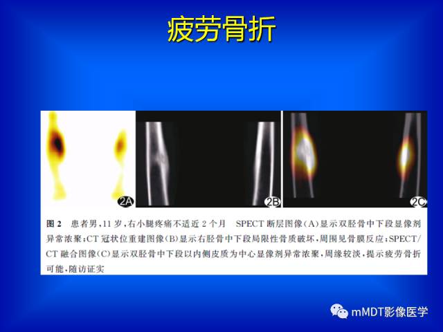 【PPT】骨骼系统核医学