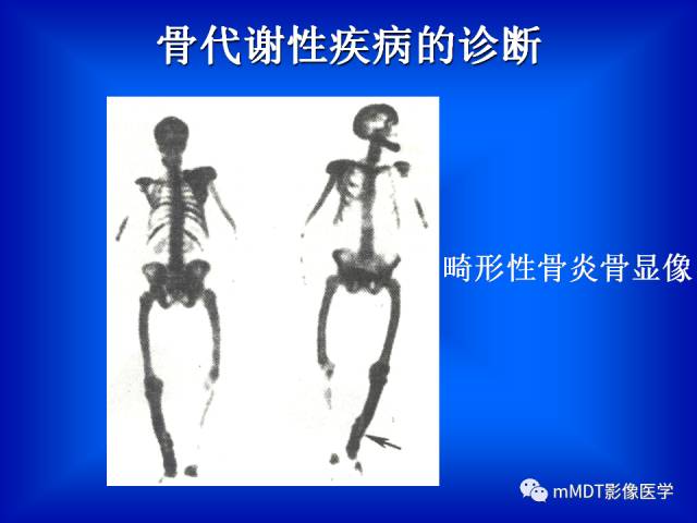 【PPT】骨骼系统核医学