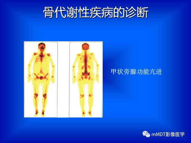 【PPT】骨骼系统核医学