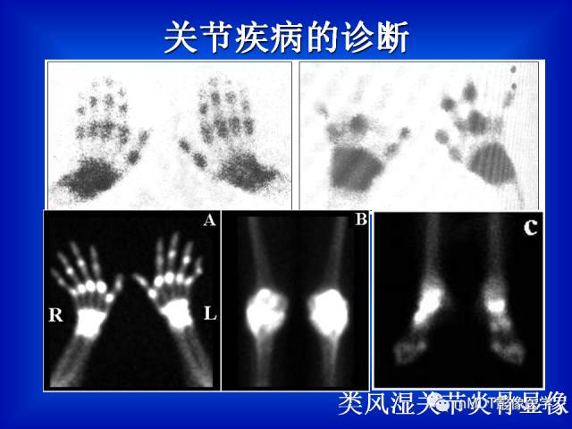 【PPT】骨骼系统核医学