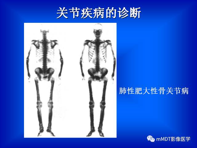 【PPT】骨骼系统核医学