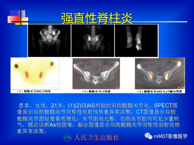 【PPT】骨骼系统核医学