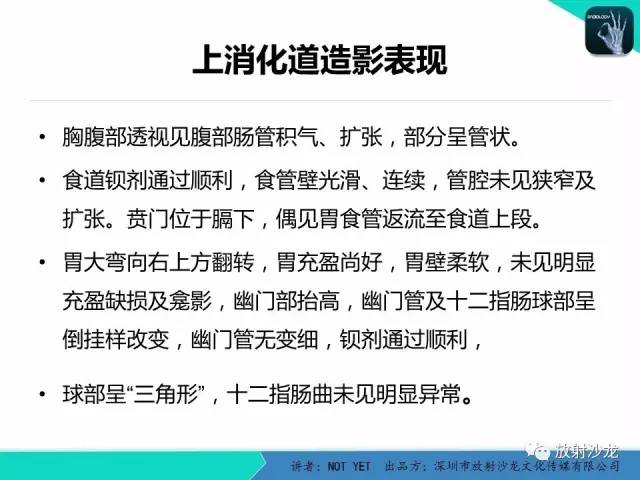 【病例】胃扭转1例X线影像表现