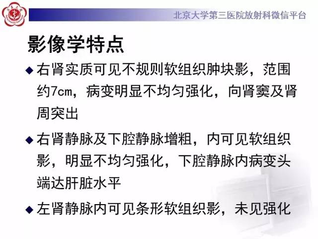【病例】肾癌伴静脉癌栓形成1例CT及MR