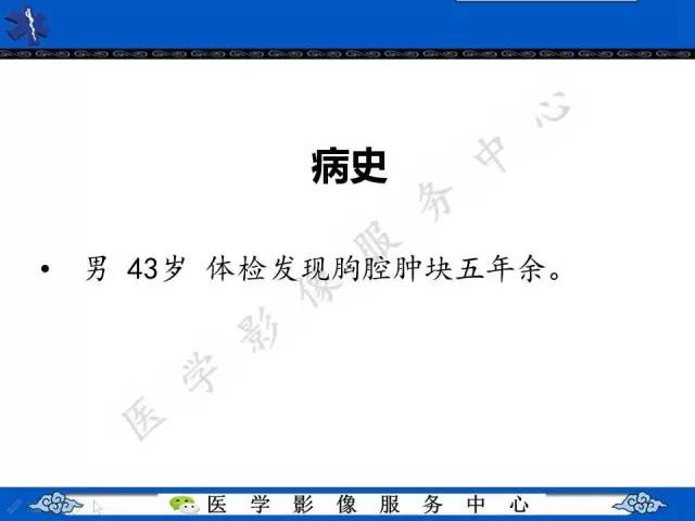 【病例】纵隔支气管囊肿1例CT影像表现